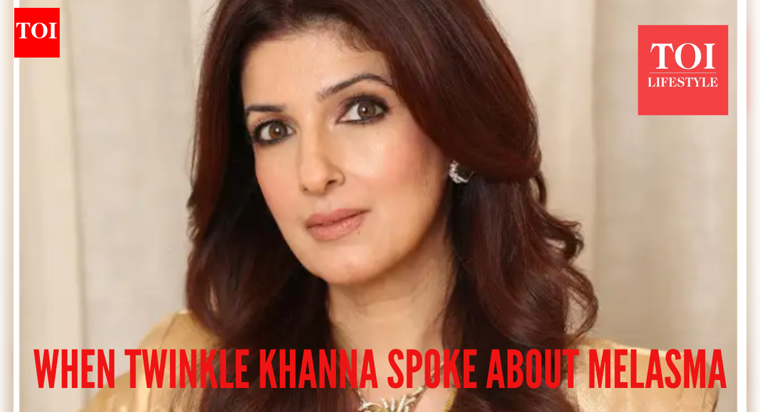 When Twinkle Khanna opened up on melasma, calling it a ‘bin bulaya mehman’: here’s what we know on the condition – The Times of India